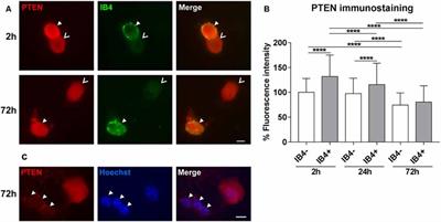 Simultaneous Knockdown of Sprouty2 and PTEN Promotes Axon Elongation of Adult Sensory Neurons